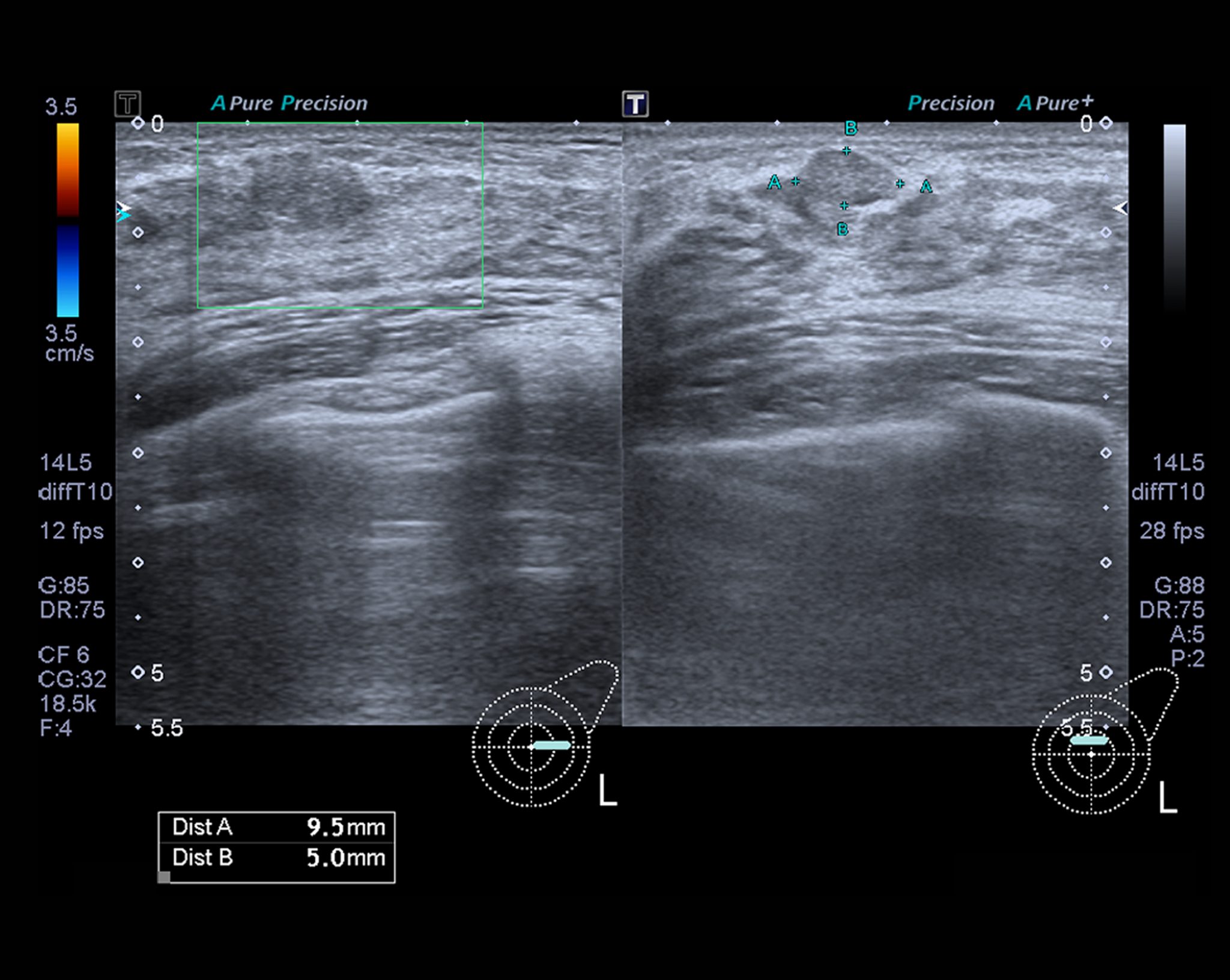 Breast Ultrasound And How It Is Used To Fight Against Breast Cancer - WCUI