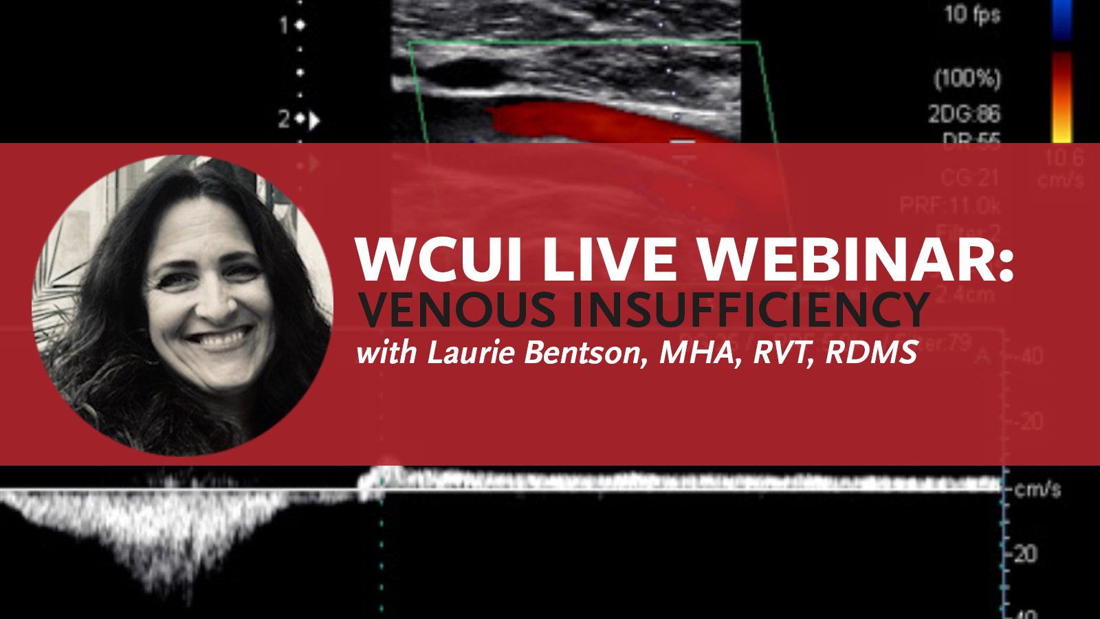 Live WCUI Webinar: Venous Insufficiency