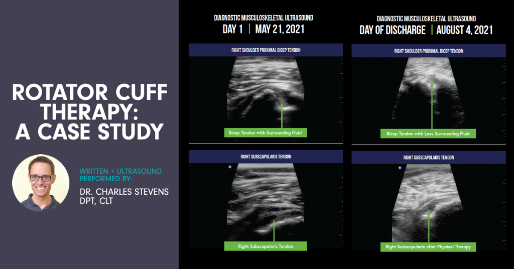 The Power of Rotator Cuff Therapy + Diagnostic Musculoskeletal Ultrasound